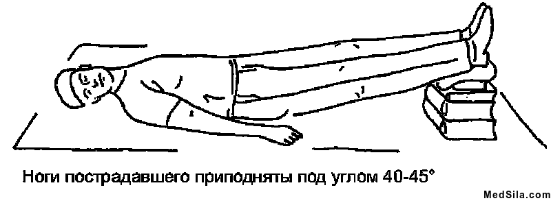 увеличение венозного возврата
